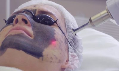 Laser Carbon Peel